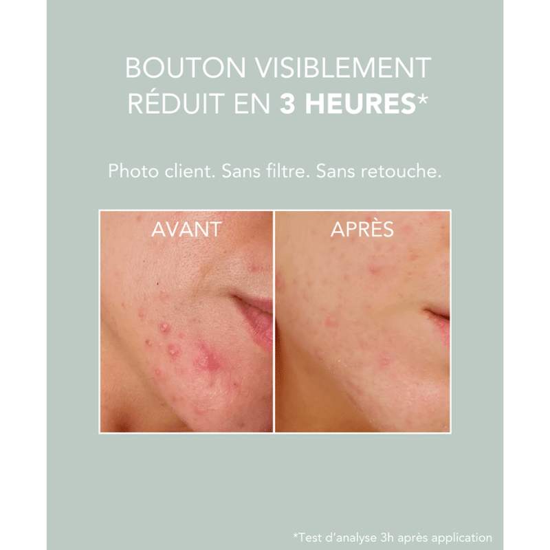 Pâte Stop Bouton – On The Wild Side – Image 4